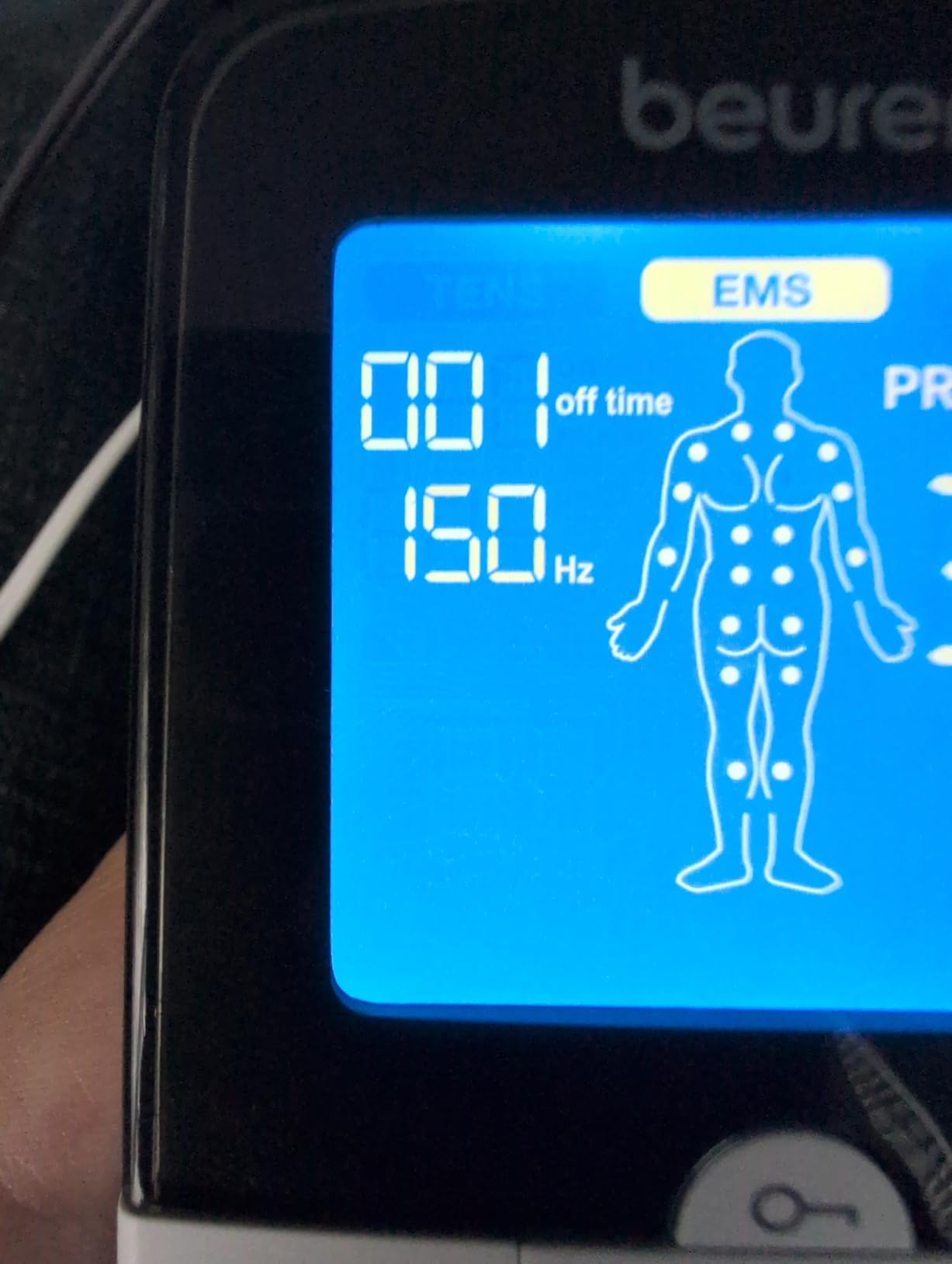 Beurer EM49 Digital TENS & EMS Device for Pain Relief and Muscle Stimulation, 15 TENS Programs, 35 EMS Programs, 2 Adjustable Channels with 4 Self-Adhesive Electrodes customer photo 2