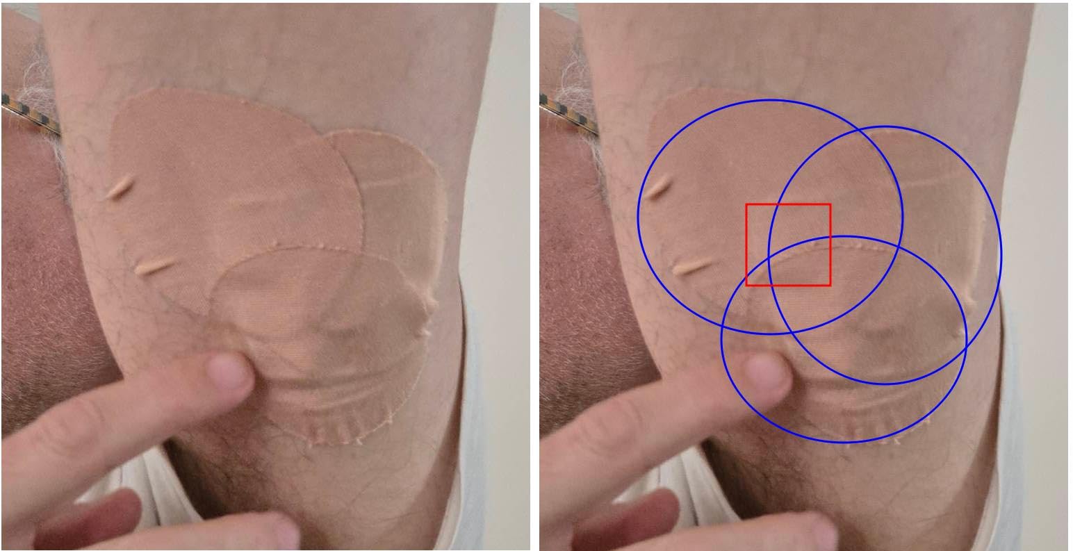 Skin Grip Adhesive Patches Compatible with Dexcom G7 & Stelo CGM - Waterproof & Sweatproof Cover for Continuous Glucose Monitor Sensor, Stays Secure for 10-15 Days - 20 Pack, Tan customer photo 2