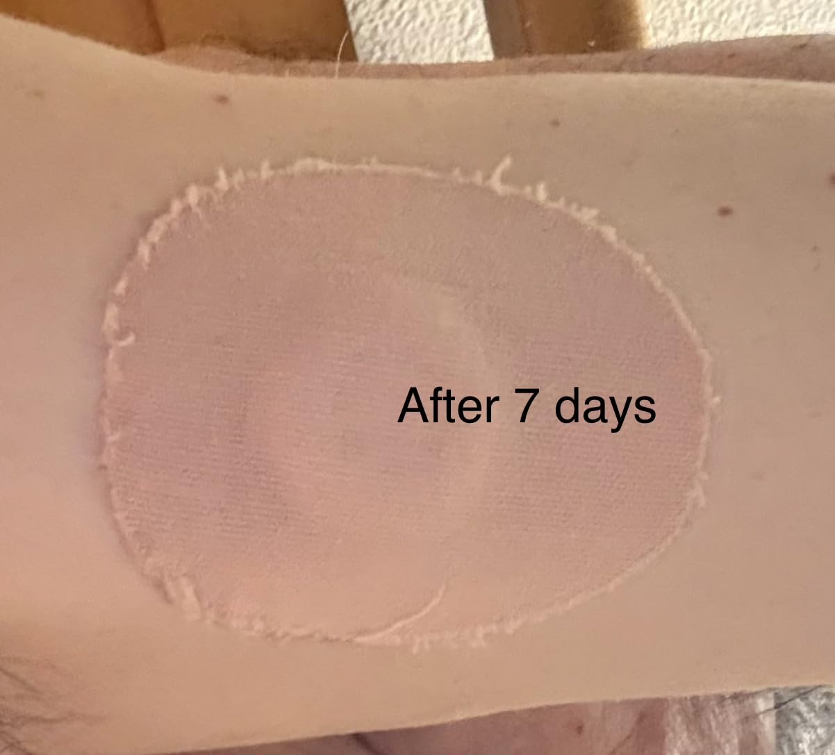 Libre 3 Sensor Covers Waterproof, 20-Pack Amolyfe Freestyle Libre 3 Plus Covers, Bump-Proof with Hard Cap, Waterproof Breathable Medical CGM Adhesive Patches, 14-Day CGM Protection (Tan) customer photo 1