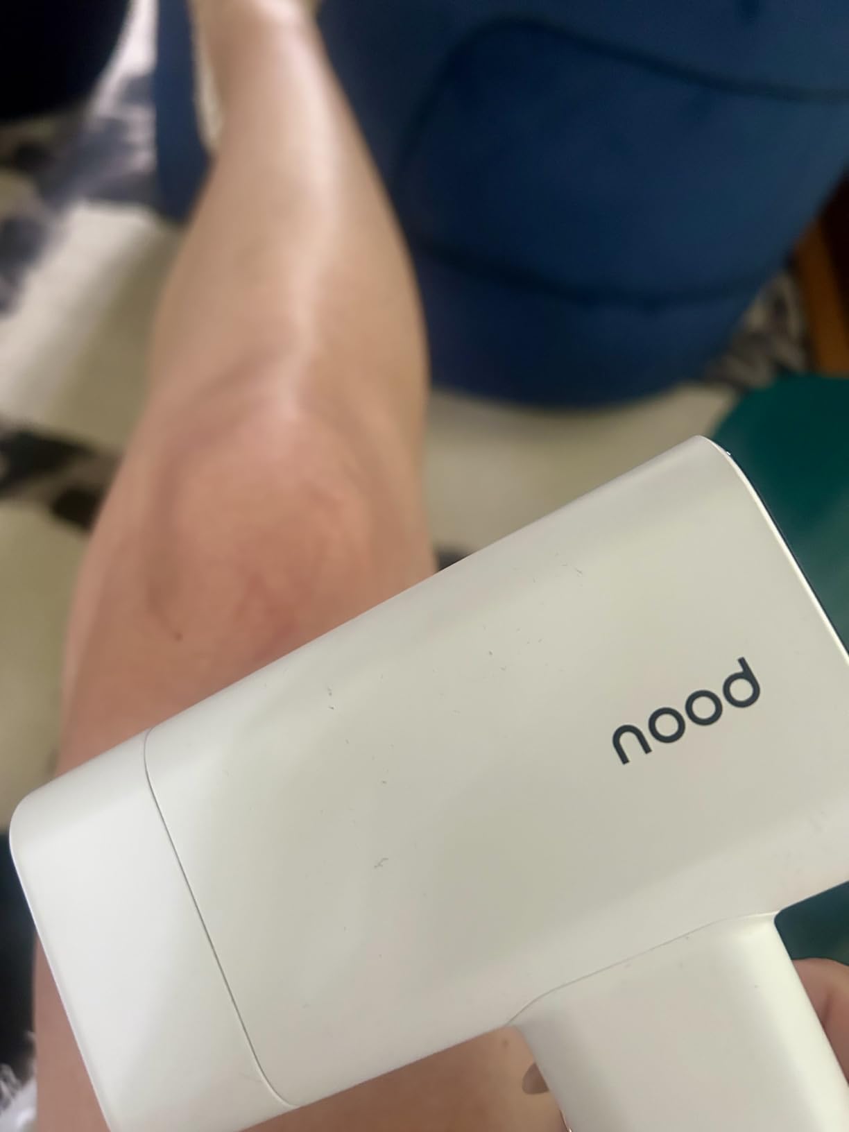 Nood Flasher Pro - Forbes Best Product 2026 - IPL Laser Hair Removal Device For At Home Use - Pain-Free, Permanent, Visible Results After First Use & Works Everywhere Hair Grows - Gloss White customer photo 2