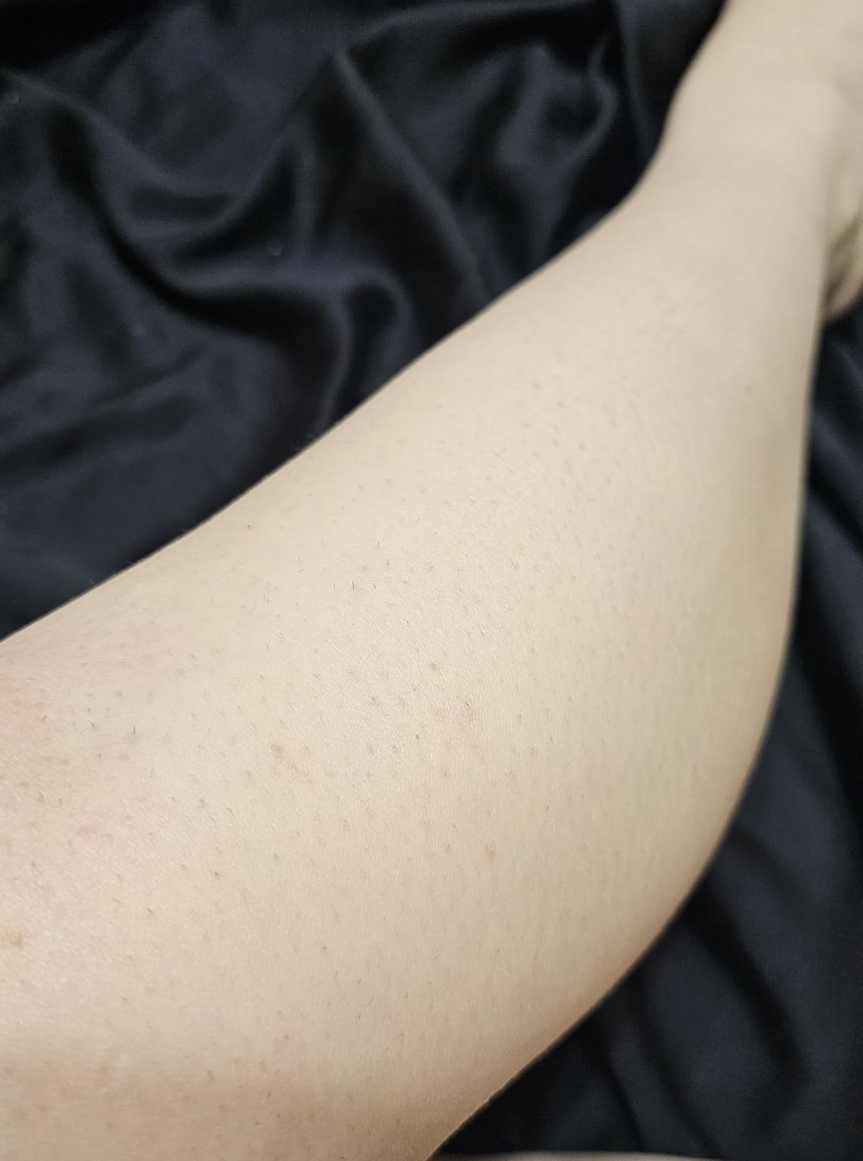 Philips Lumea IPL - Salon-Like Laser Hair Removal for Women, Permanent Hair Reduction Device At Home for Face & Body - Safe & Painless for Face, Bikini, Body, 5 Settings & Skin Sensors, BRI984/03 customer photo 1