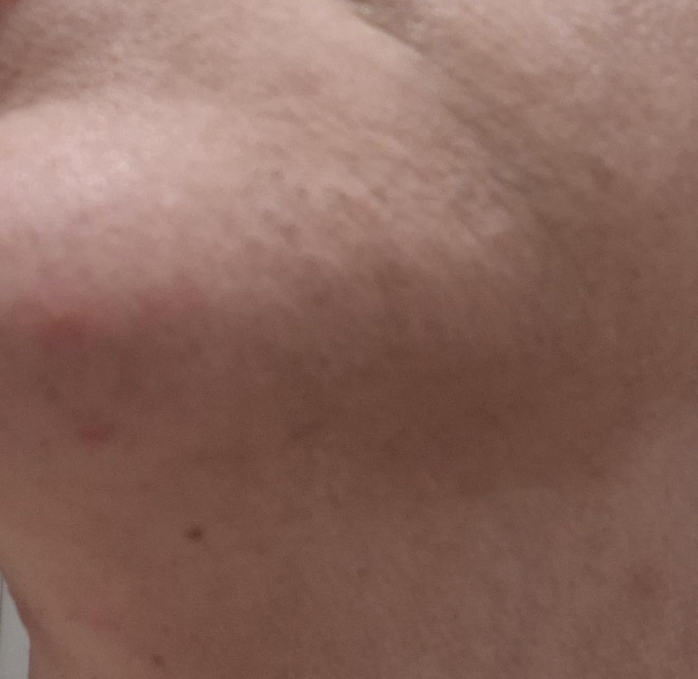 Braun Smart IPL, Skin i·Expert Pro 7, VOGUE's Best Hair Removal Device, IPL Hair Removal for Women and Men, Permanent Laser Hair Reduction At-Home, World's 1st Smart App, 4 Heads, IPL7387 customer photo 1