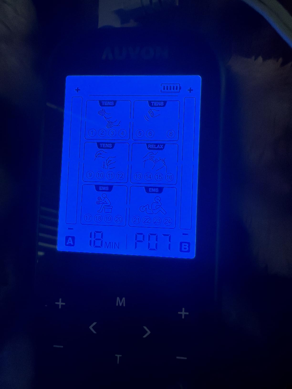 AUVON 3-in-1 TENS Unit Muscle Stimulator, EMS Massage Machine with 40 Intensities for Gradual Shoulder, Sciatica, Back Pain Relief, 24 Modes Rechargeable Electronic Pulse Massager with 12 TENS Pads customer photo 1