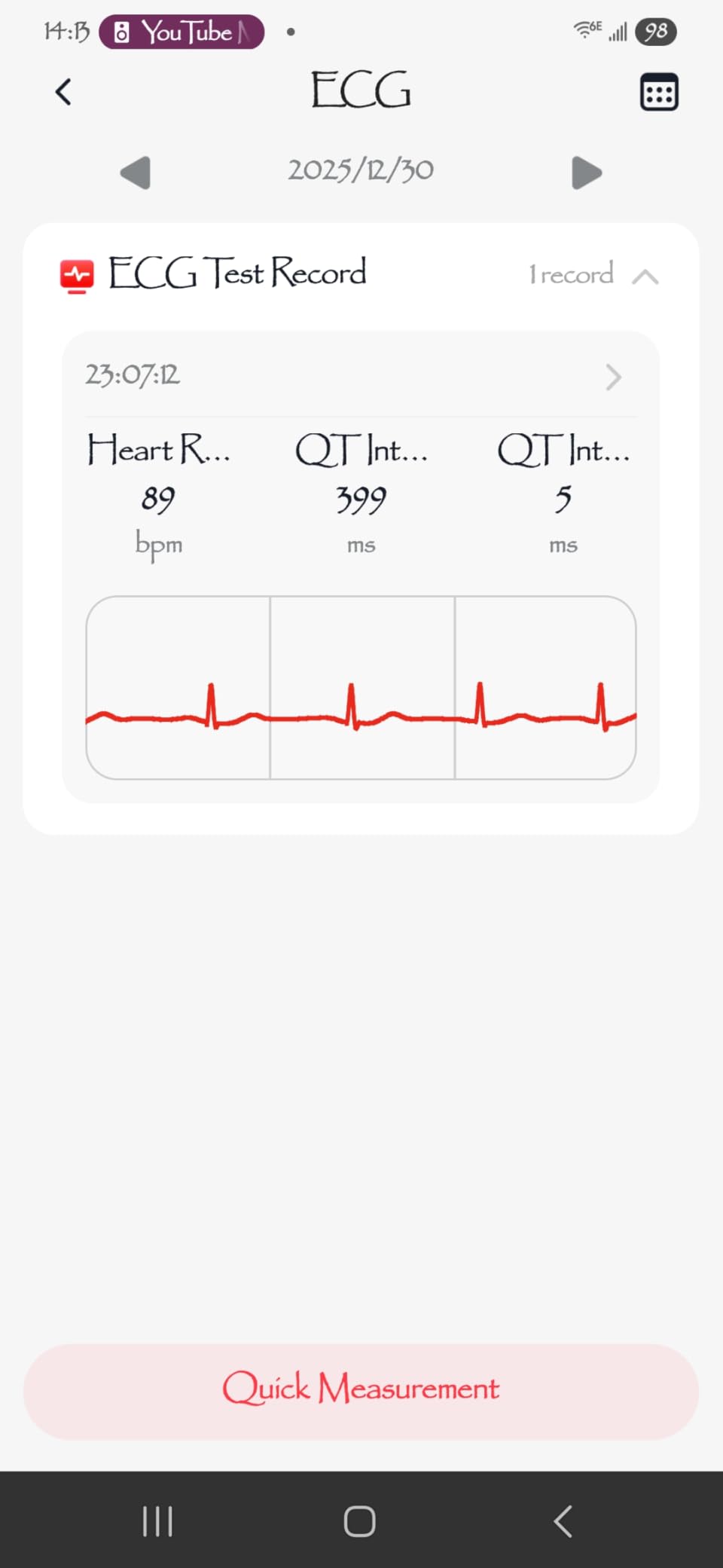 Blood Pressure Smart Watch (Answer/Make Calls), 2.06