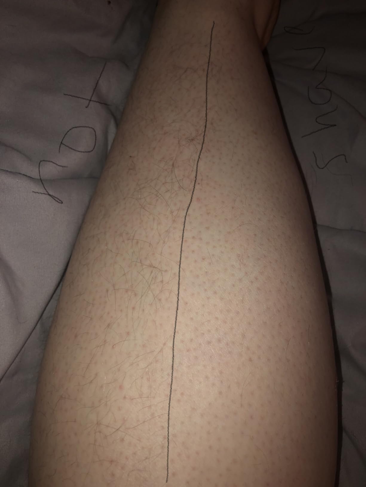 Philips SatinShave Essential Women’s Wet & Dry Electric Shaver for Legs & Body, Cordless, with Hypoallergenic Foil, HP6306/50 customer photo 1