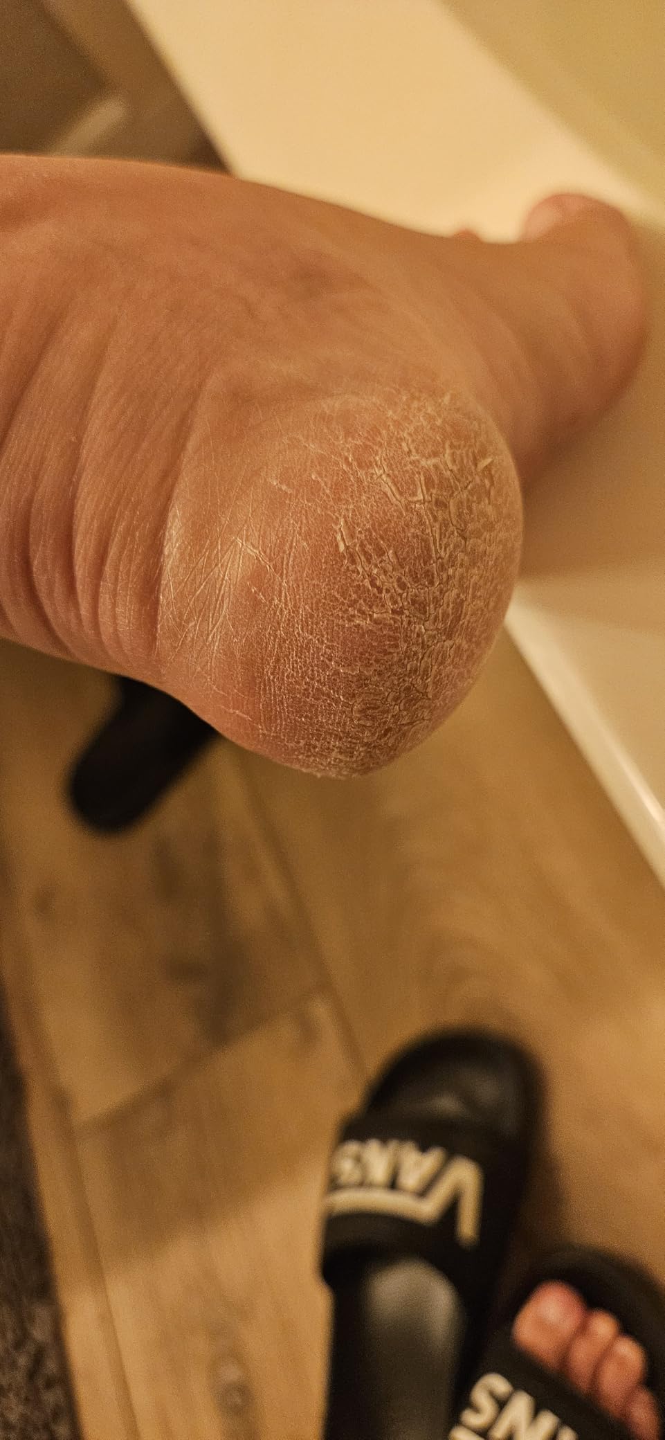 Colossal Foot rasp Foot File and Callus Remover. Best Foot Care Pedicure Metal Surface Tool to Remove Hard Skin. Can be Used on Both Wet and Dry feet, High Grade Stainless Steel File customer photo 2