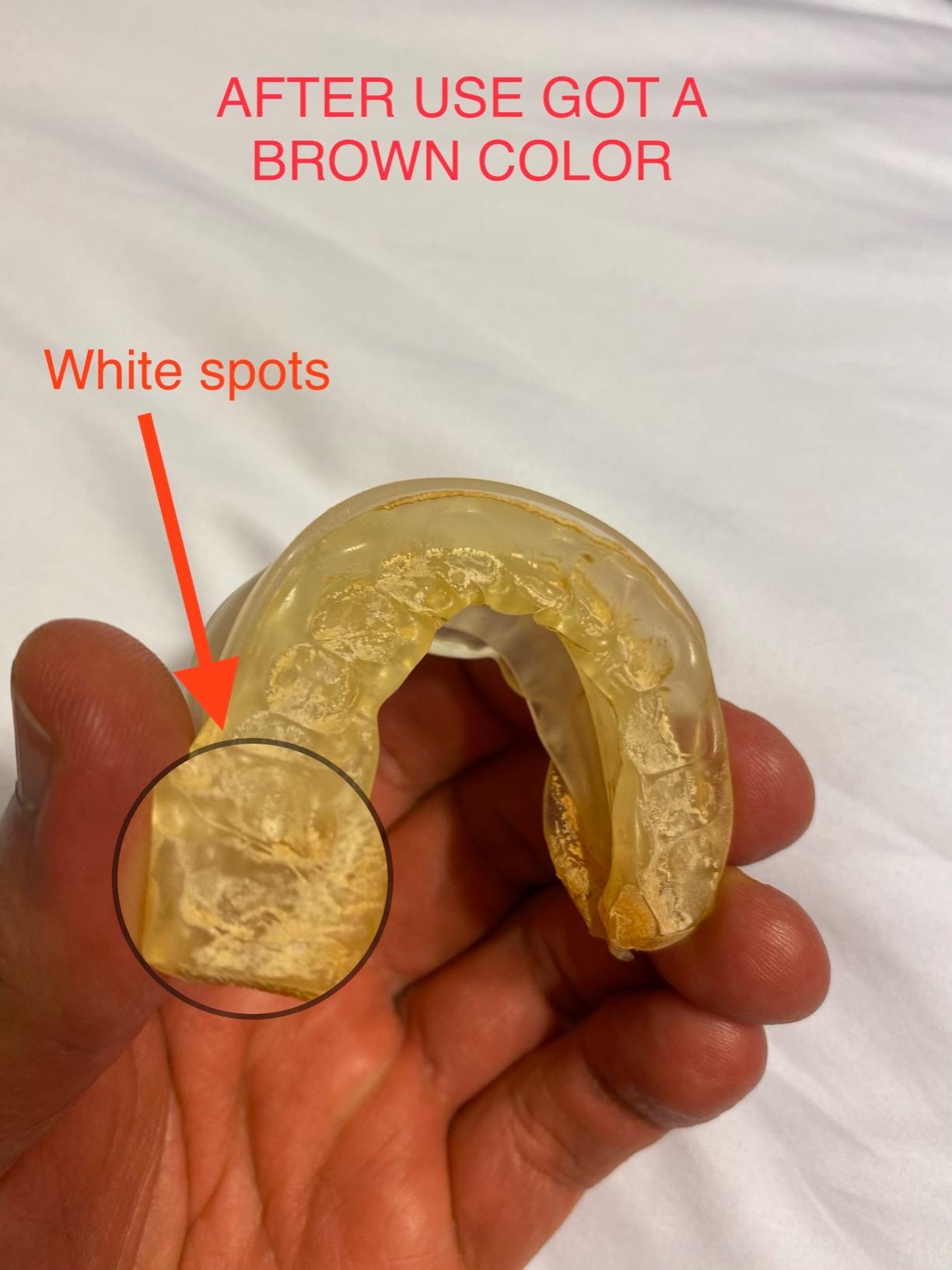 PureSleep - The Original Anti-Snoring Mouthpiece and #1 Solution Worldwide customer photo 2