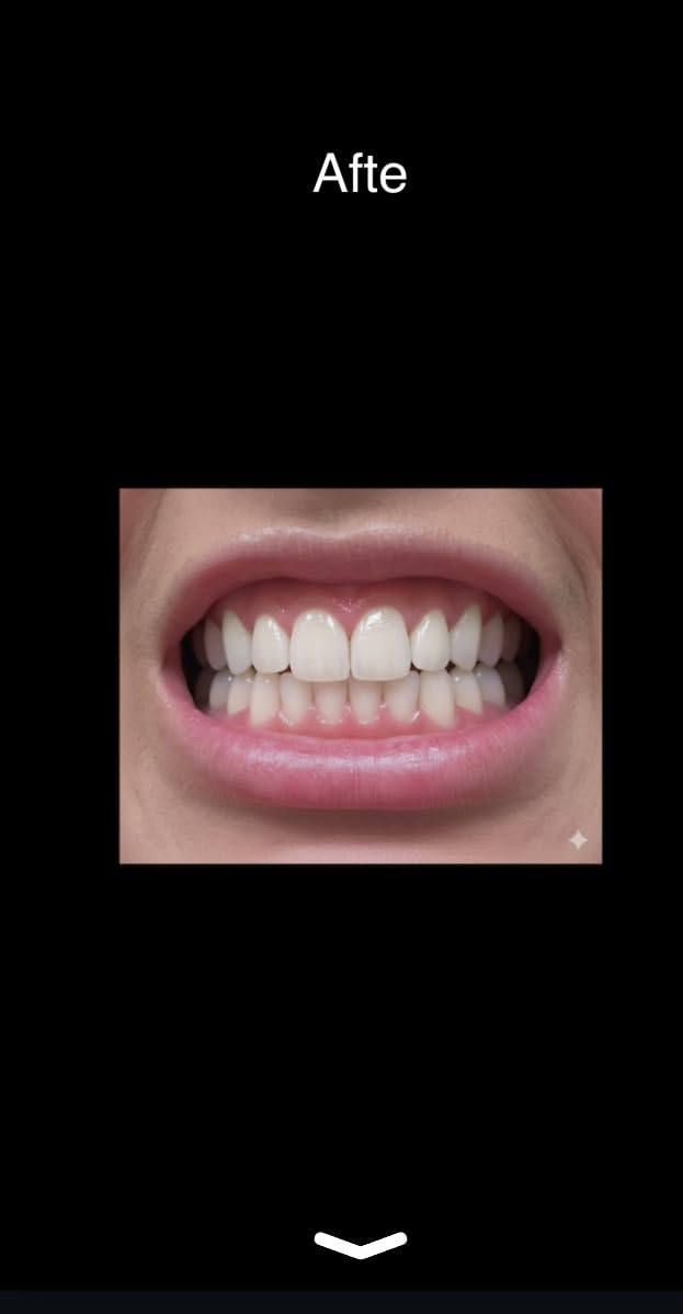 Auraglow Teeth Whitening Pen – Extra Strength 9% Hydrogen Peroxide, 40+ Treatments, No Sensitivity, Removes Coffee Wine Tea Stains, Whiten Teeth Fast, Enamel Safe, Made in USA, 4mL customer photo 1