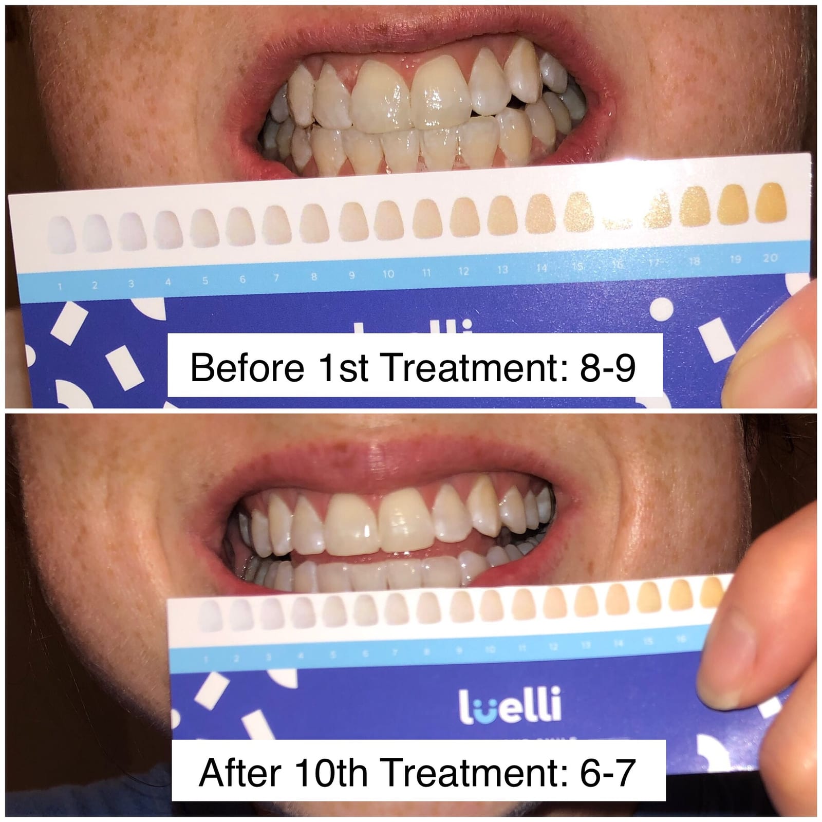 Luelli Teeth Whitening Pen, 50+ Uses - Travel Size Professional Tooth Whitener Gel, Extra Strength Organic Teeth Bleaching Gel for Sensitive Teeth, Instant Stain Removal, Simply White Smile, 4 Count customer photo 1