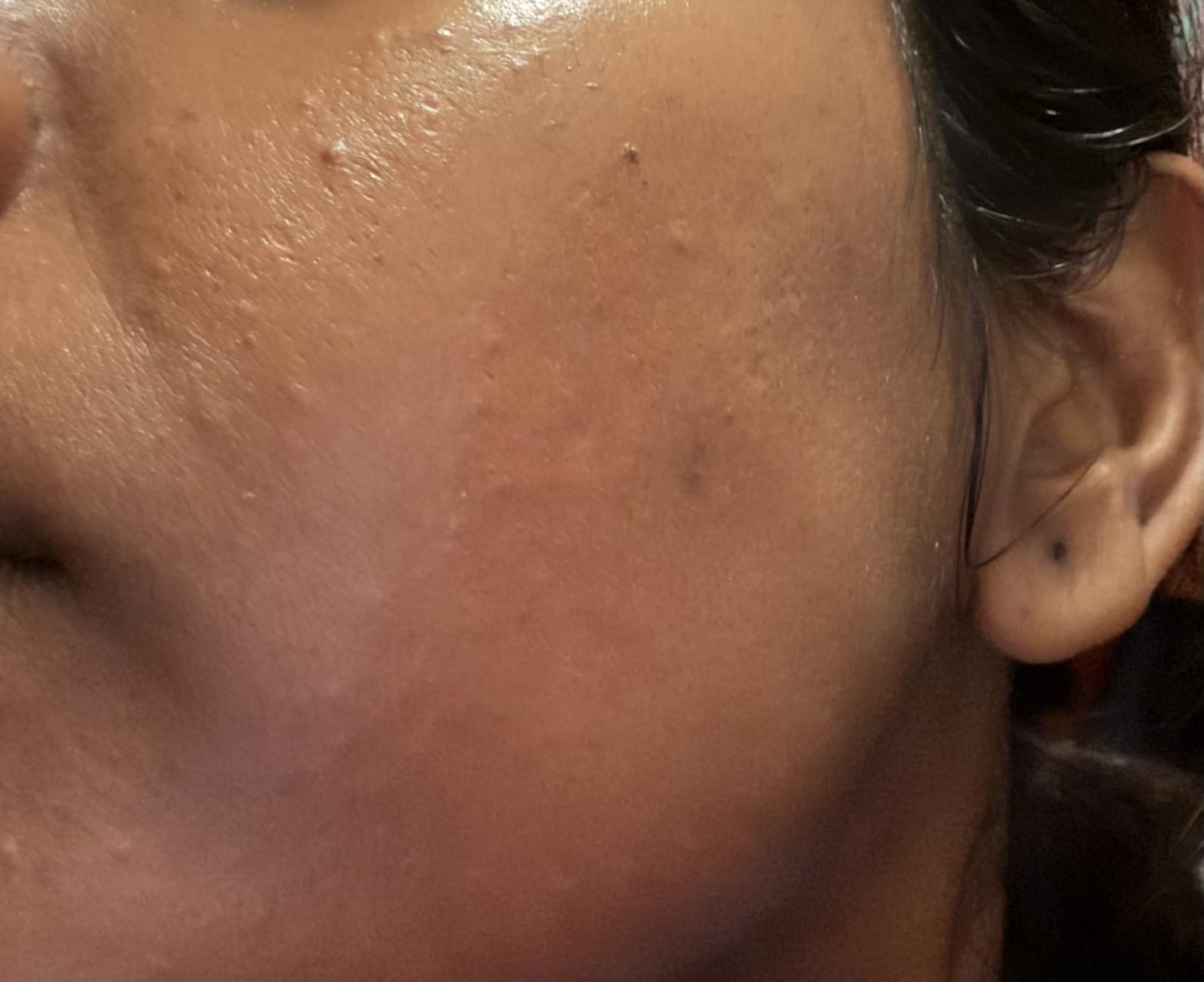 La Roche-Posay Cicaplast Balm B5, Barrier Repair Cream for Dry Skin customer photo 1