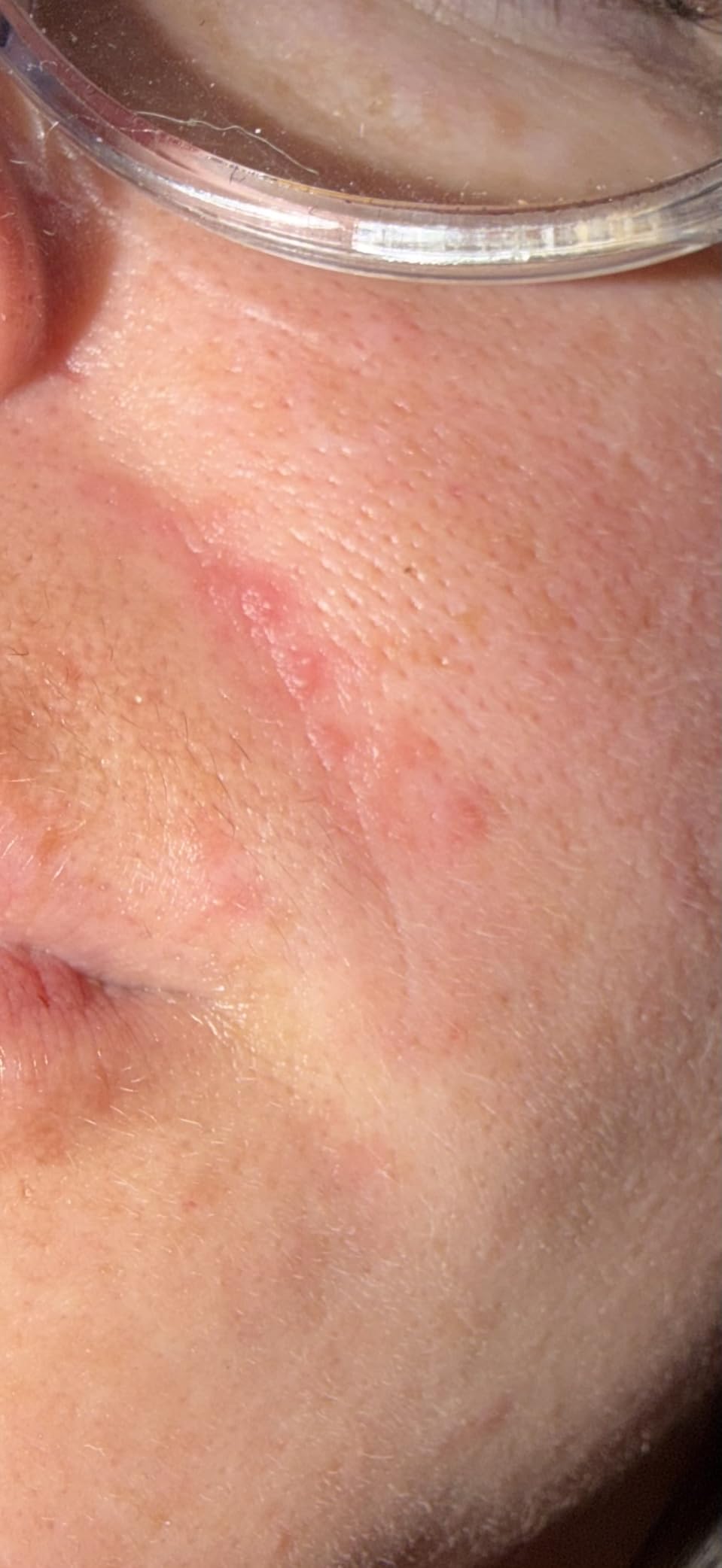 Paula's Choice SKIN PERFECTING 2% BHA Liquid Leave-On Exfoliant customer photo 1