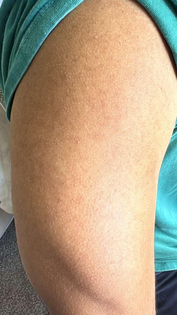 CeraVe Salicylic Acid Body Wash, Exfoliates Rough and Bumpy Skin, 10oz customer photo 1