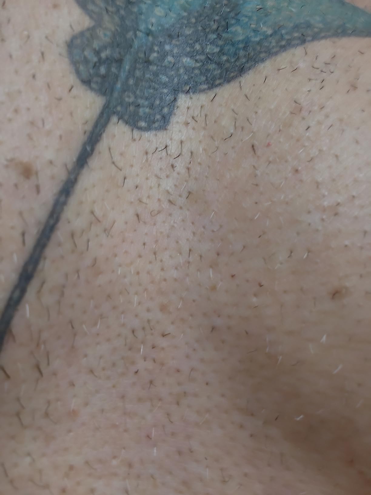 Braun IPL, Silk·Expert Pro 5, IPL Hair Removal for Women and Men, Permanent Laser Hair Reduction At-Home, 4 Heads, IPL5347 customer photo 1